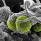 Illustration for article titled Deadly Superbugs Are Breeding Like Crazy in Chinese Sewage Plants